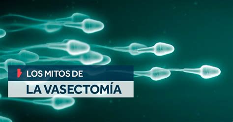 ¡cuáles Son Los Mitos Y Realidades De La Vasectomía