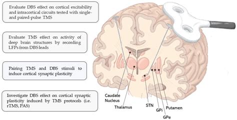 Brain Sciences Free Full Text Combining Transcranial Magnetic