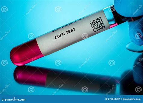 O Que É Egfr No Exame De Sangue - Exame De Sangue Do Egfr Para Adultos Mais Velhos. Exame De Sangue ...