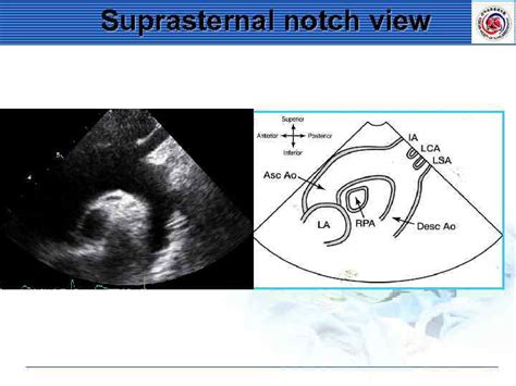 Standard Imaging Of Transthoracic Echocardiography Terminology A