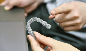 Invisalign Zahnschienen alles was du darüber wissen musst