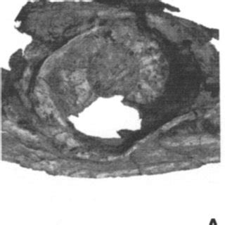 Diagram Of An Ichthyosaur Sclerotic Ring A Equatorial View B