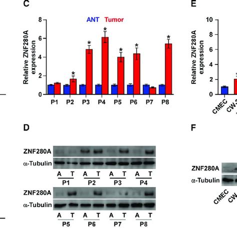 Znf A Is Upregulated In Crc Tissues And Cells A Znf A Expression