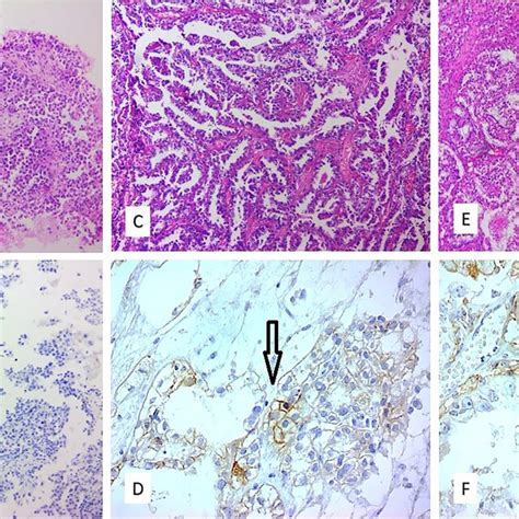 Microscopic Examination Of Hematoxylin And Eosin And Ihc Stained