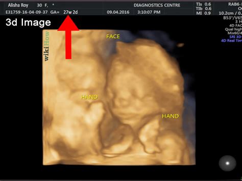 How To Read An Ultrasound Picture Steps With Pictures