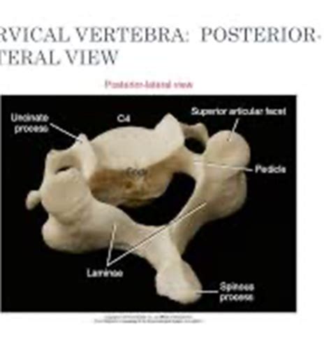 Cervical Spine Anatomy Flashcards Quizlet