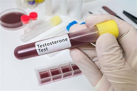 Understanding The Benefits And Risks Of Testosterone Prescription VU