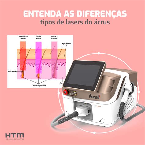 Entenda os diferentes tipos de tratamento de depilação a laser Casa