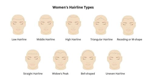 Understanding Hair Transplant Guide To Different Hairline Types