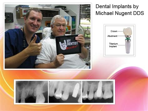 Dental Implant Dentist Michael Nugent Dds The Pasadena Dentist