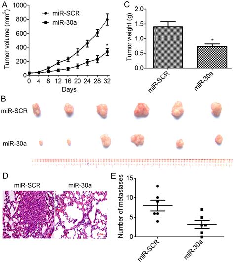 MiR30a Inhibits Epithelialmesenchymal Transition And Metastasis In