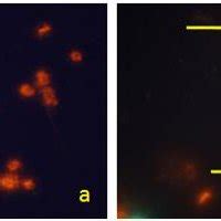 Comet Assay Single Cell Gel Electrophoresis Of The MSCs Extracted