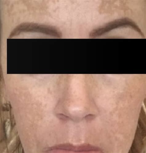 Obagi Medical Skin Care Mediface Aesthetics Skin Care Doncaster