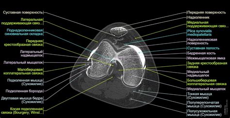 Колено КТ-артрография : нормальная анатомия | e-Anatomy
