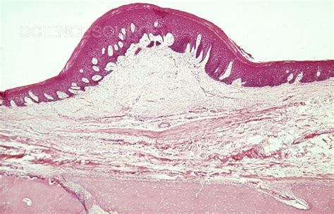 Photograph Stratified Squamous Epithelium Lm Science Source Images