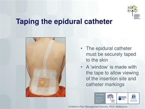 Epidural Catheter Markings