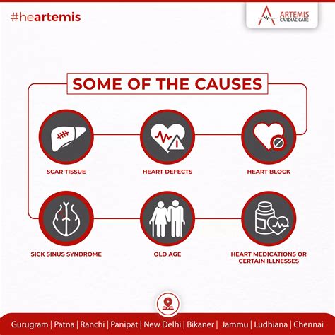 Revolutionizing Arrhythmia Diagnosis and Treatment | PDF