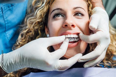 Doctor Putting A Clear Dental Aligner To The Patient Woman Stock Photo