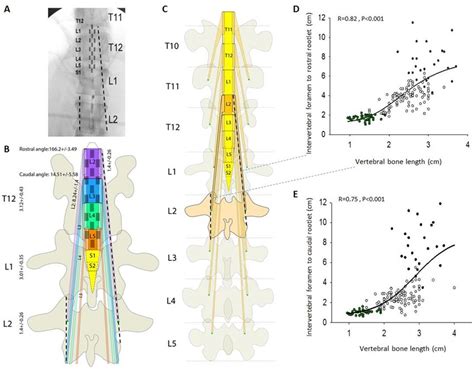 Vertebral Spine And Spinal Cord Anatomic Relationship For Segment Download Scientific Diagram