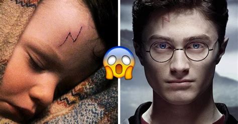 Teor A Afirma Que La Cicatriz De Harry Potter No Es Un Rayo