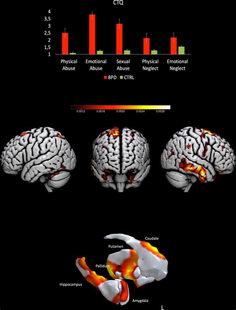 Frontiers Structural Features Predict Sexual Trauma And Interpersonal