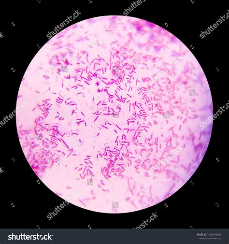 Gram Staining Bacteria Under Microscope Stock Photo (Edit Now) 1065340382