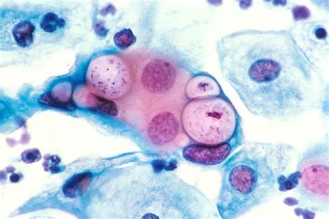 Chlamydia Bacteria - Classification, Characteristics and Microscopy