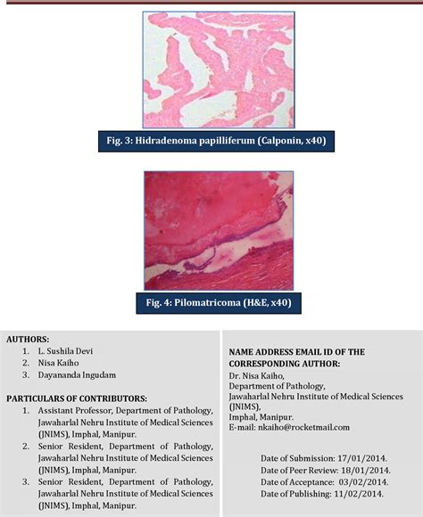 Hidradenoma Papilliferum Clinical