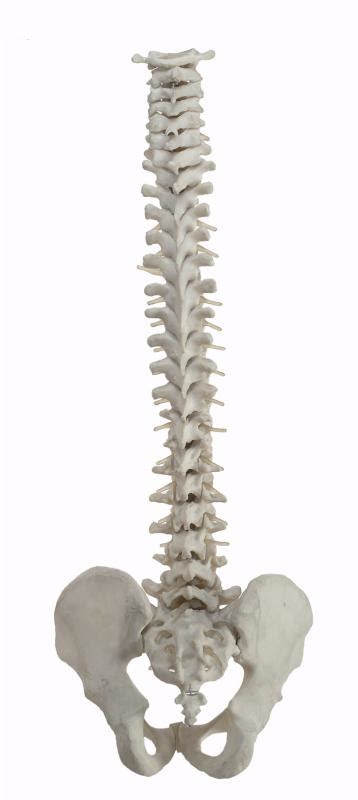 What are Spinal Fractures? (with pictures)