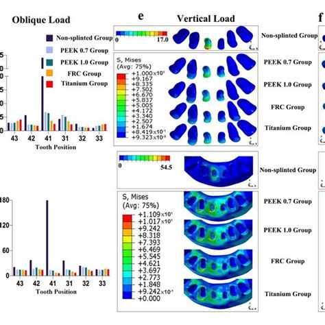 Maximum Von Mises Stresses And Occlusal Views Of Stress Distributions