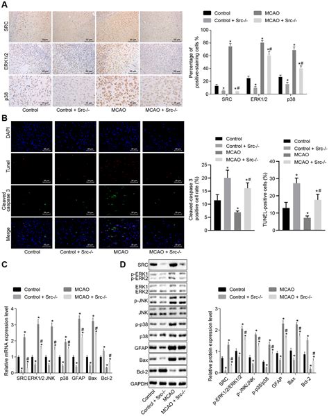 Mir 137 Prevents Inflammatory Response Oxidative Stress Neuronal