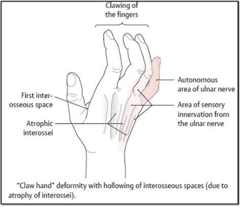 Ulnar Nerve Muscle Supply Test - Infoupdate.org