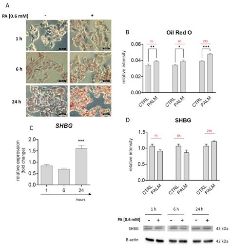 Cells Free Full Text Sex Hormone Binding Globulin Shbg Mitigates