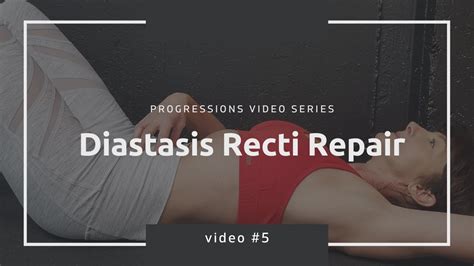 Diastasis Recti Repair For Men Too Video 5 Youtube