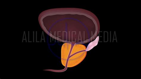 Alila Medical Media Male Reproductive System Videos