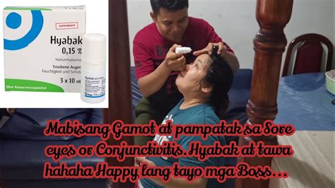 Mabisang Gamot At Pampatak Sa Sore Eyes Or Conjunctivitis Pinaka