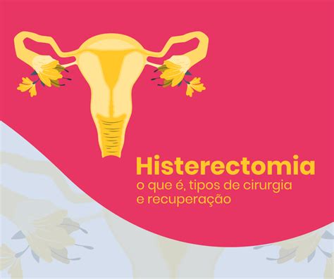 Histerectomia O que é tipos de cirurgia e recuperação Salú