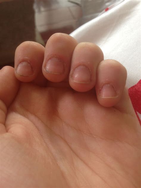 How To Fix And Grow Out Bitten Nails B C Guides