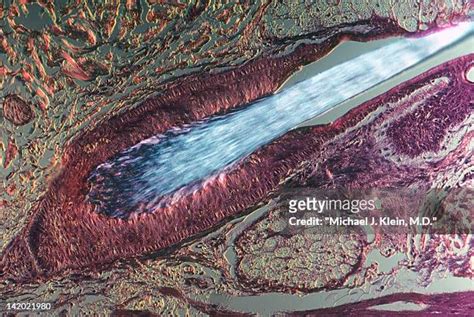 Hair Follicle Close Up Photos And Premium High Res Pictures Getty Images