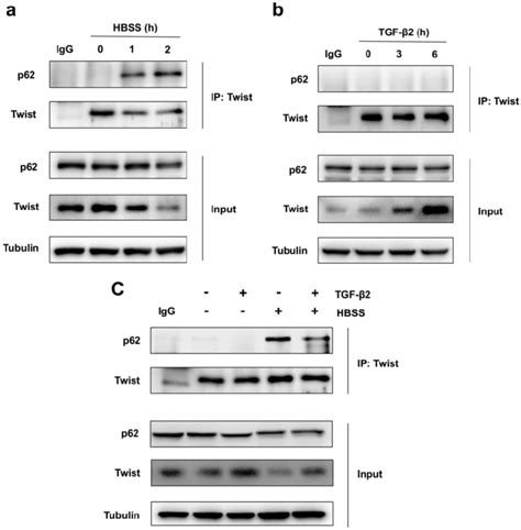 Autophagy Promotes Twist Bind To P62 A Immunoblotting With