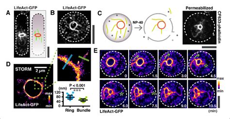 Large actin bundles are expelled during actomyosin ring contraction ...