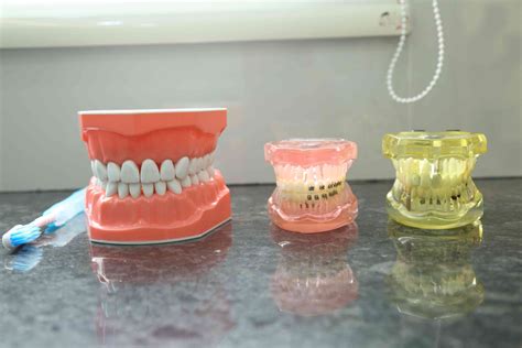 Gallery Laxmi Dental Care