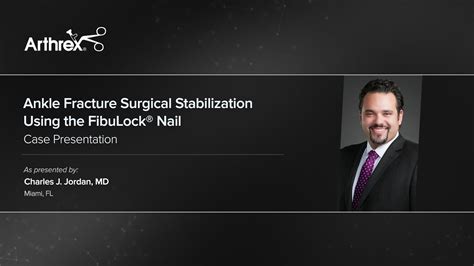 Arthrex Ankle Fracture Surgical Stabilization Using The Fibulock Nail