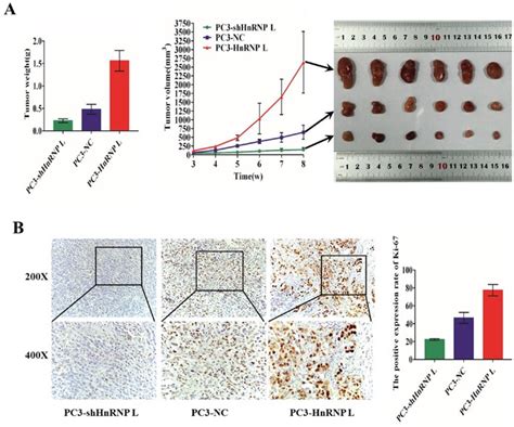 HnRNP L Promotes Prostate Cancer Progression By Enhancing Cell Cycling