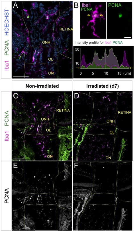 A Iba1 Positive Cells With And Without Nuclear Expression Of The