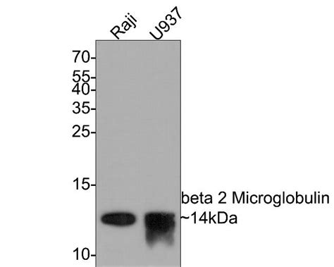 Beta 2 Microglobulin Recombinant Monoclonal Antibody Su35 05 Ma5 45029