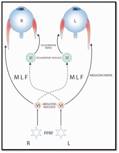 Medial Longitudinal Fasciculus Pons