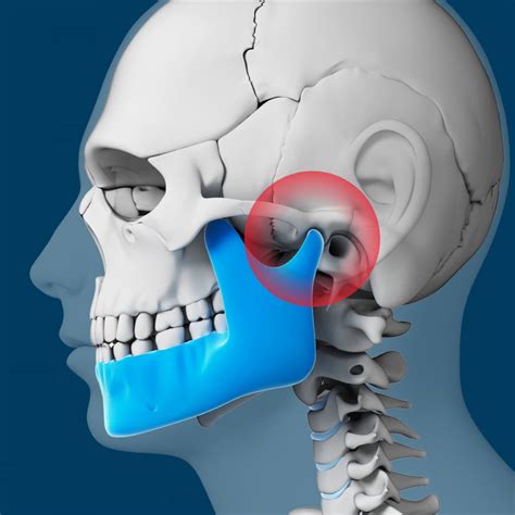 Can Wisdom Teeth Cause Tmj Boston Dentist Congress Dental Group