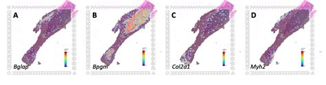 Is Healthy Bone Compatible With The Visium Cytassist Spatial Gene