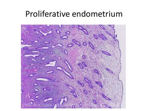 Approach To Endometrial Biopsy